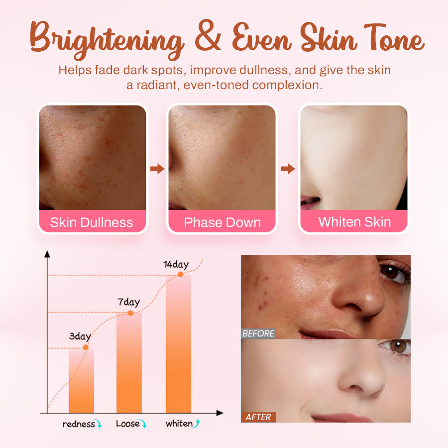 LOVILDS™ Whitening and Freckle - Removing Mask 🔥Last Day Promotion 49% OFF🔥